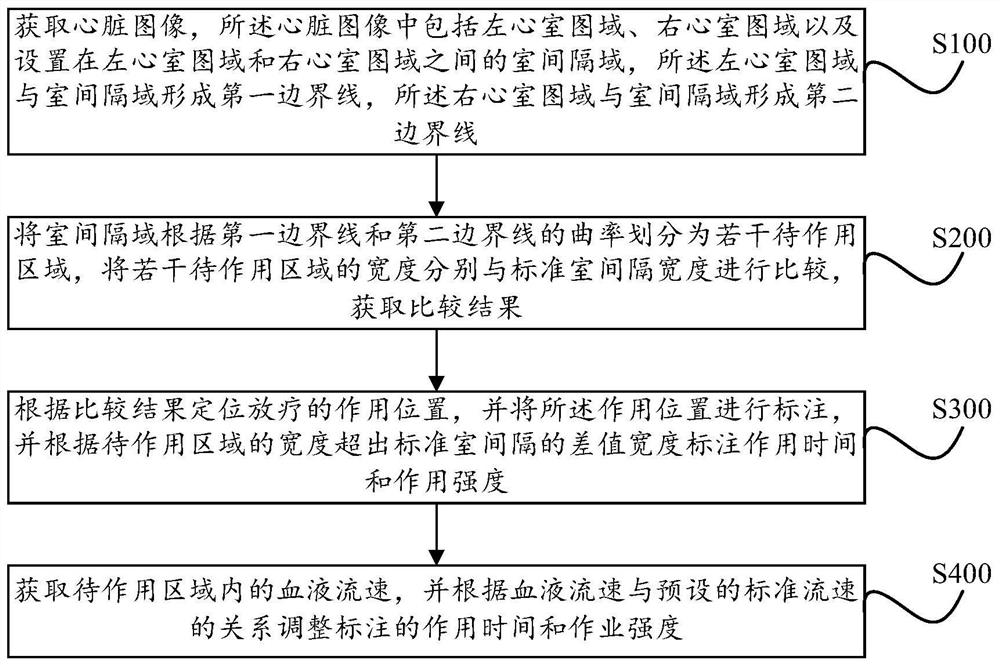 Heart image processing method for radiotherapy accurate positioning