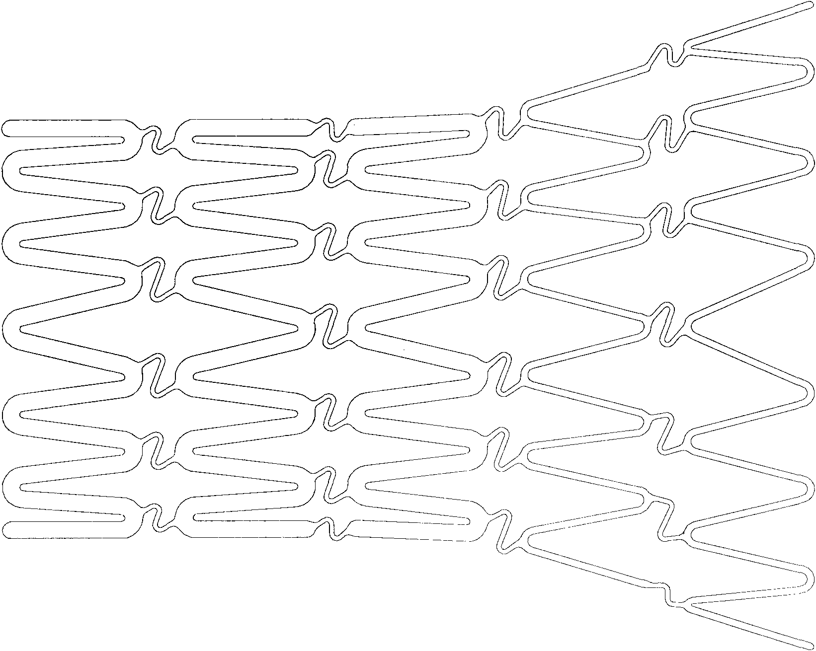 Outflow track expandable stent and conveyor thereof