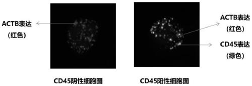 Reagent kit for detecting CD45 gene expression