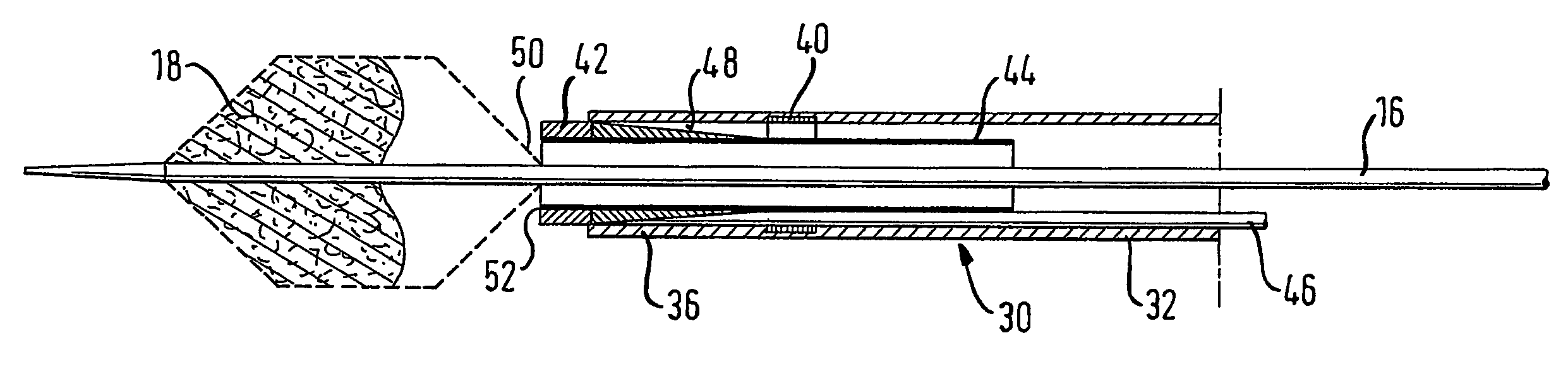 Retrieval catheter