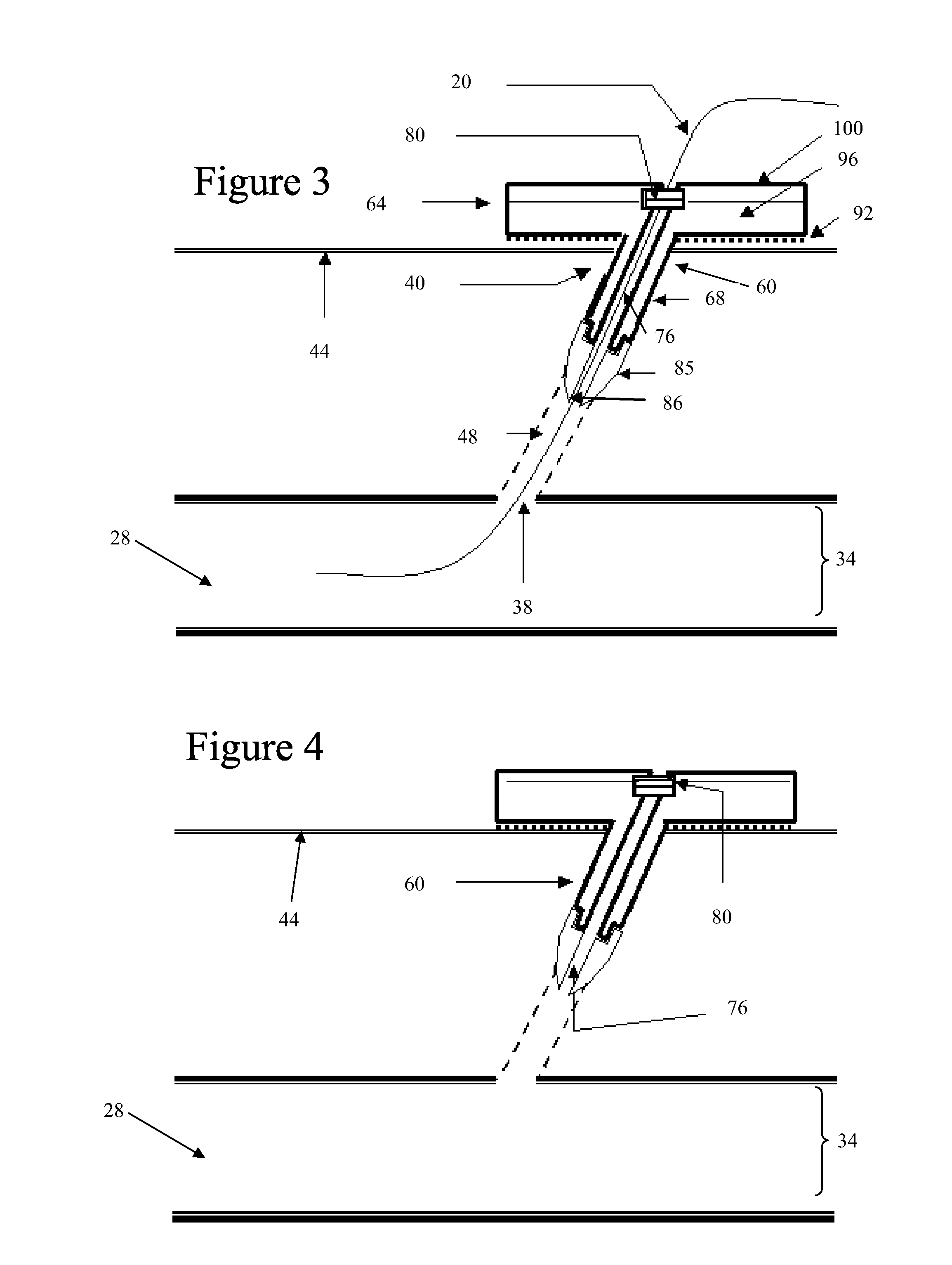 Hemostatic Bandage