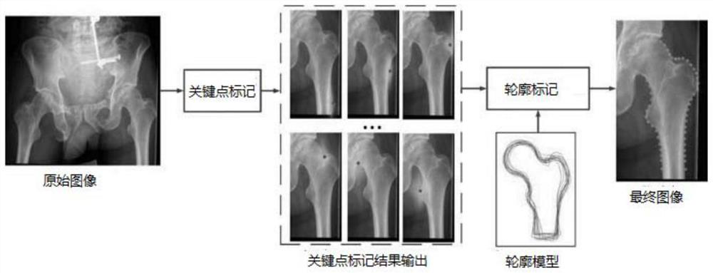 Automatic identification and model reconstruction method for anatomical features in medical image