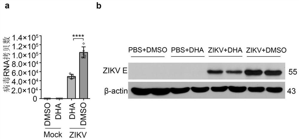 Drugs to alleviate neonatal microcephaly associated with Zika virus infection