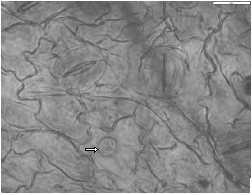 Microscopic slide preparation method for observing characteristics of lower surface of folium artemisiae argyi