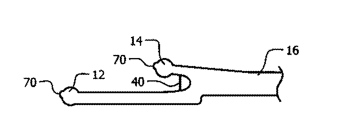 Device for minimally invasive tendon sheath release having static blade