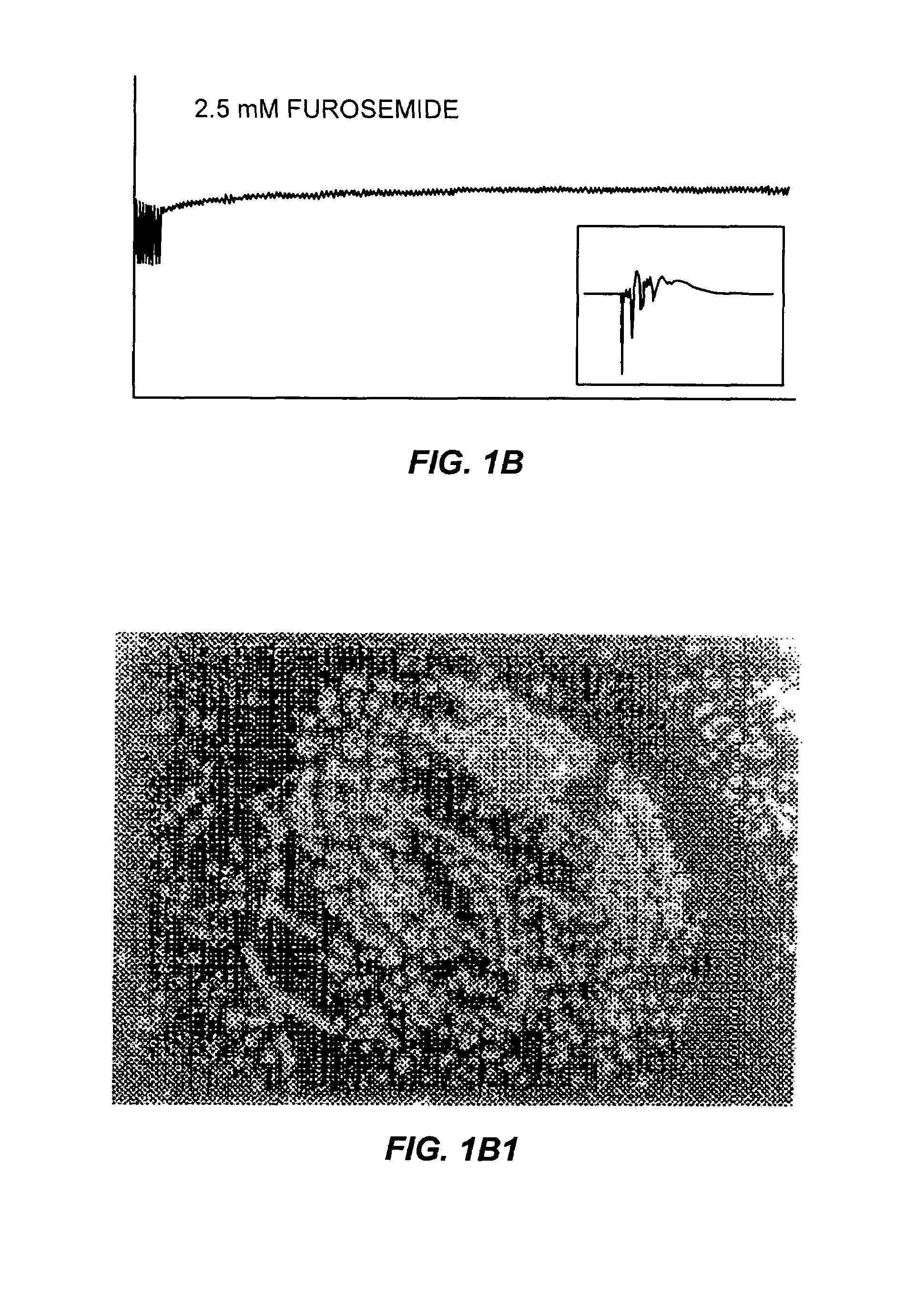 Method of treating migraine headache without aura