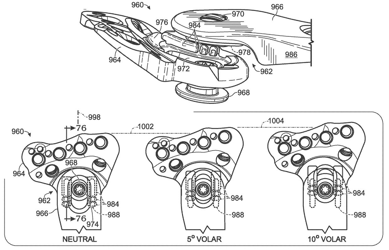 Bone plate with movable joint