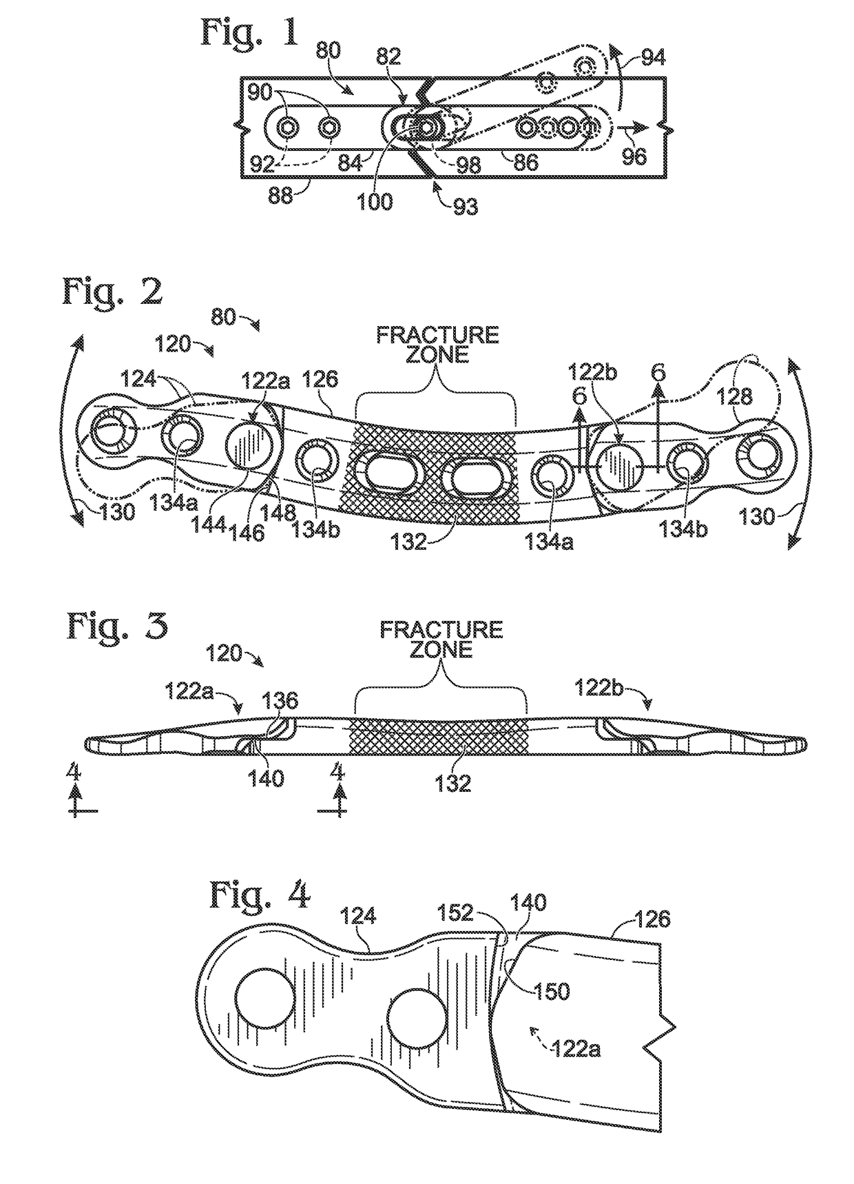 Bone plate with movable joint