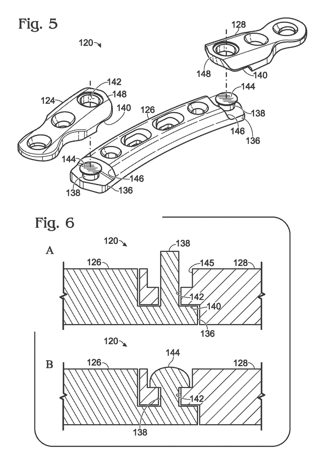 Bone plate with movable joint