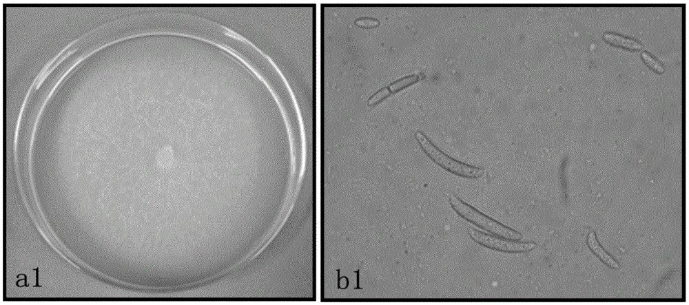 Application of sophora tonkinensis endophytic fungus TRXY-34-1 in prevention and treatment of panax notoginseng black spot