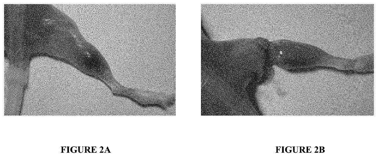 Injectable Botulinum Toxin Formulations And Methods Of Use Thereof Having Long Duration Of Therapeutic Or Cosmetic Effect