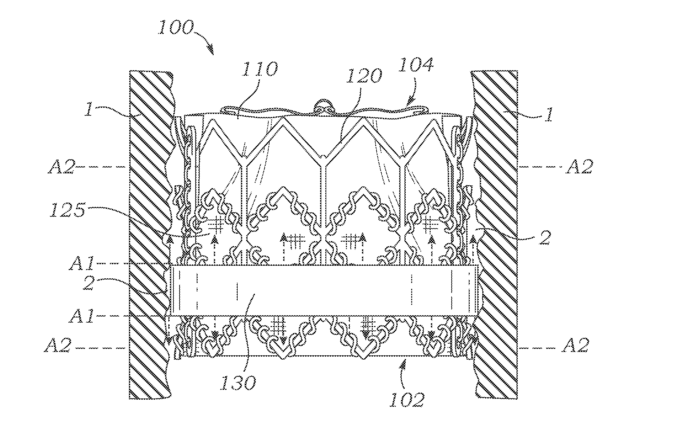 Bioprosthetic heart valves having adaptive seals to minimize paravalvular leakage