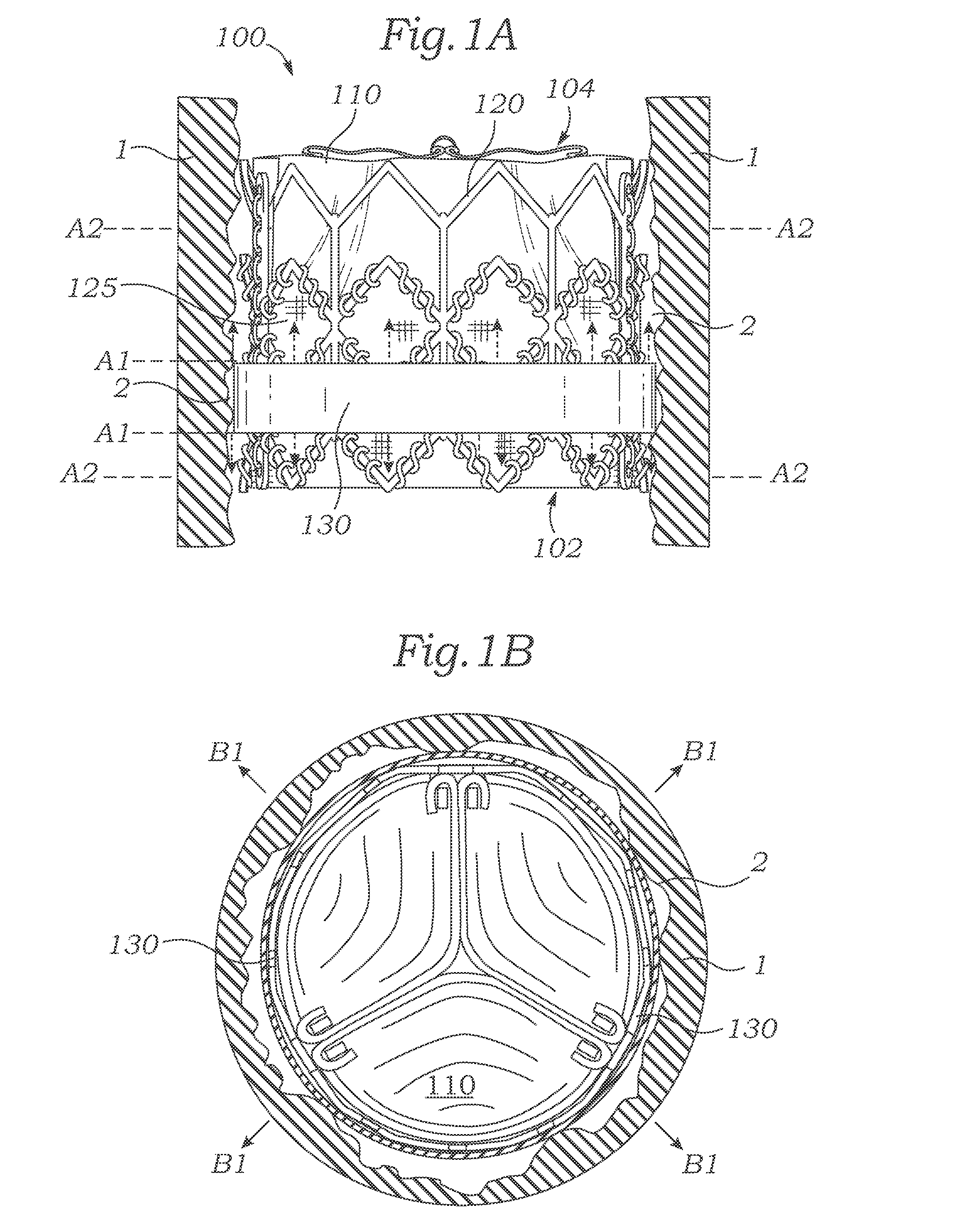 Bioprosthetic heart valves having adaptive seals to minimize paravalvular leakage