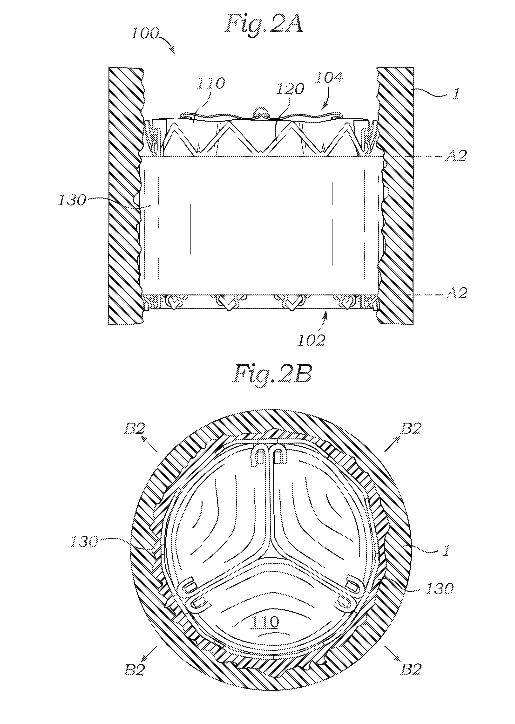 Bioprosthetic heart valves having adaptive seals to minimize paravalvular leakage