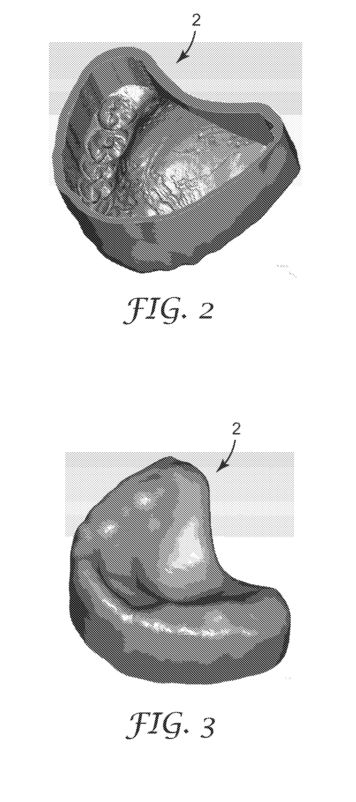 Digitally forming a dental model for fabricating orthodontic laboratory appliances