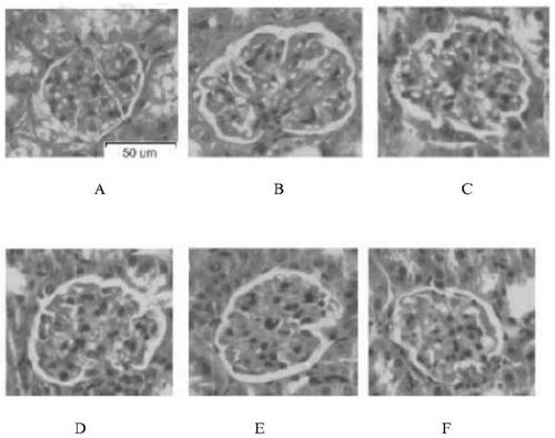 Bisindole maleimide derivative and its preparation method and use