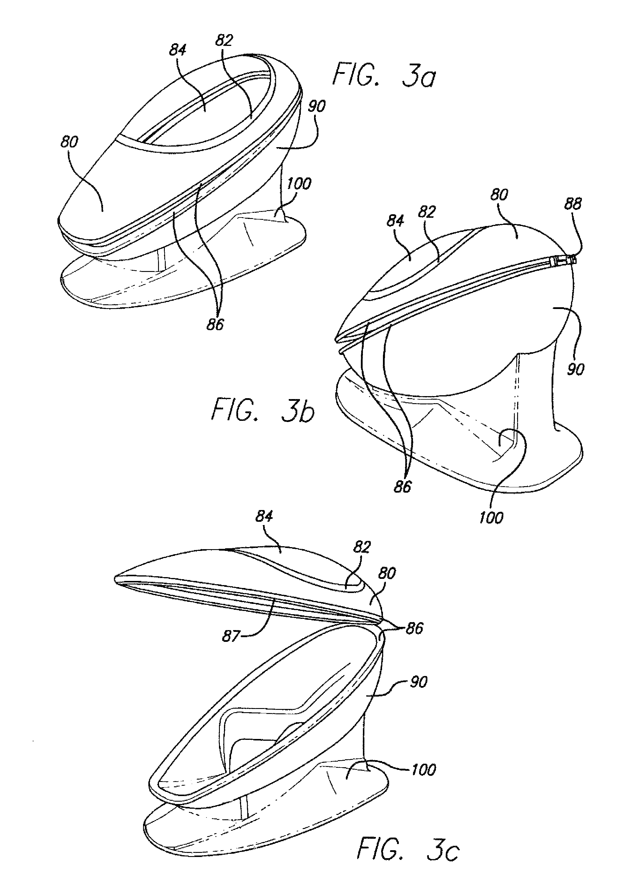 Method and apparatus for cyclic variations in altitude conditioning