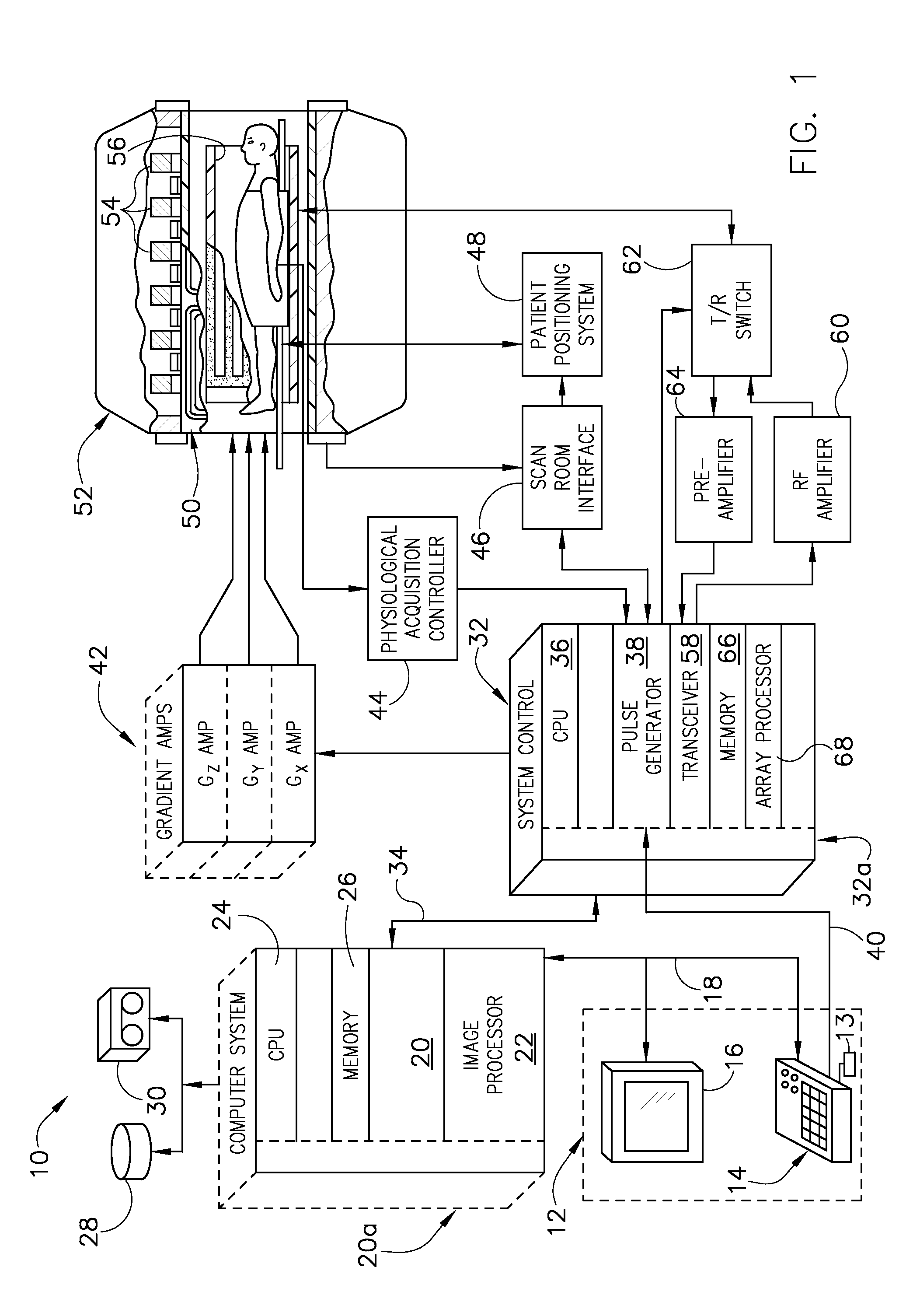 Method and apparatus for correcting distortion in MR images caused by metallic implants