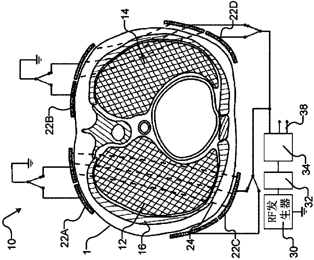 System for treating unwanted tissue