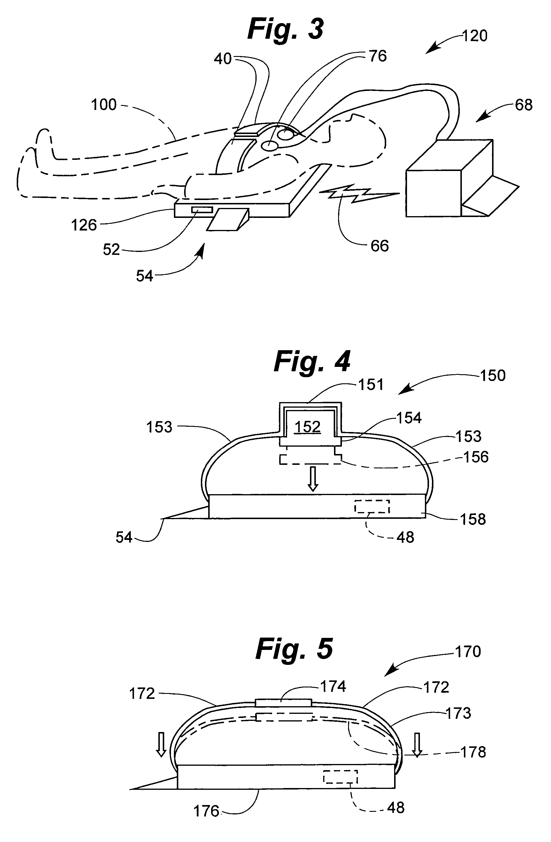 Cooperating defibrillators and external chest compression devices