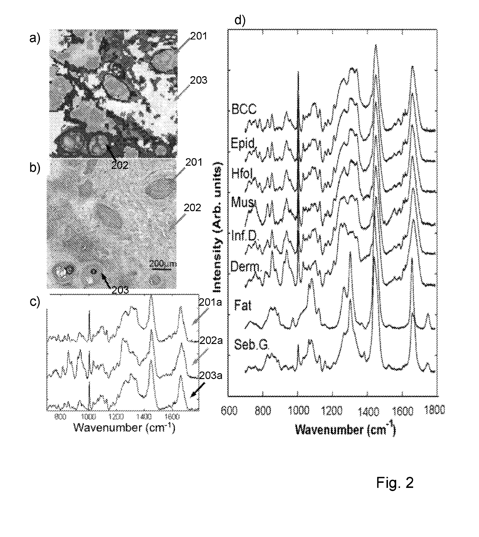 Measurement of tissue structures