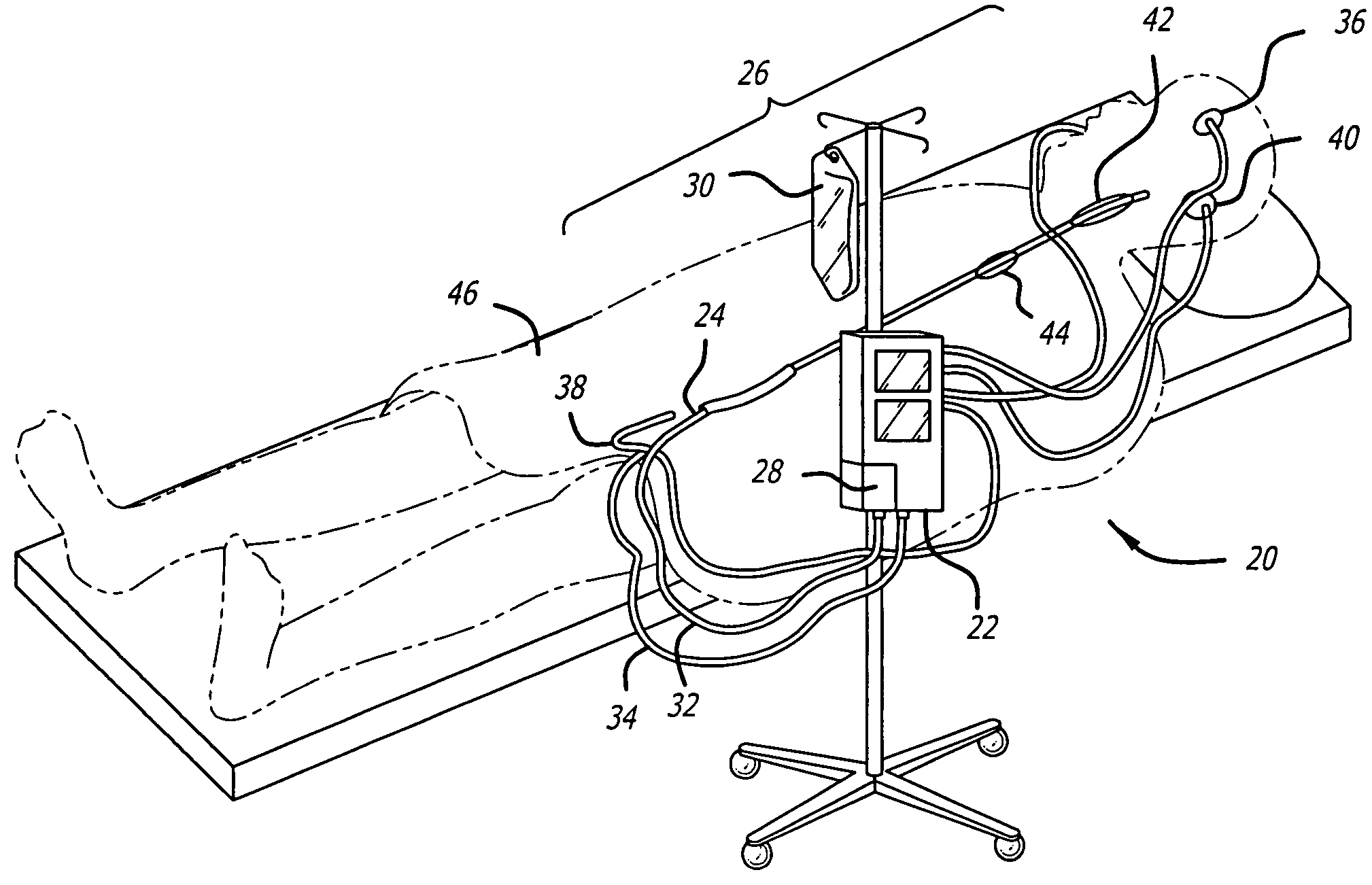 Apparatus and method for providing enhanced heat transfer from a body