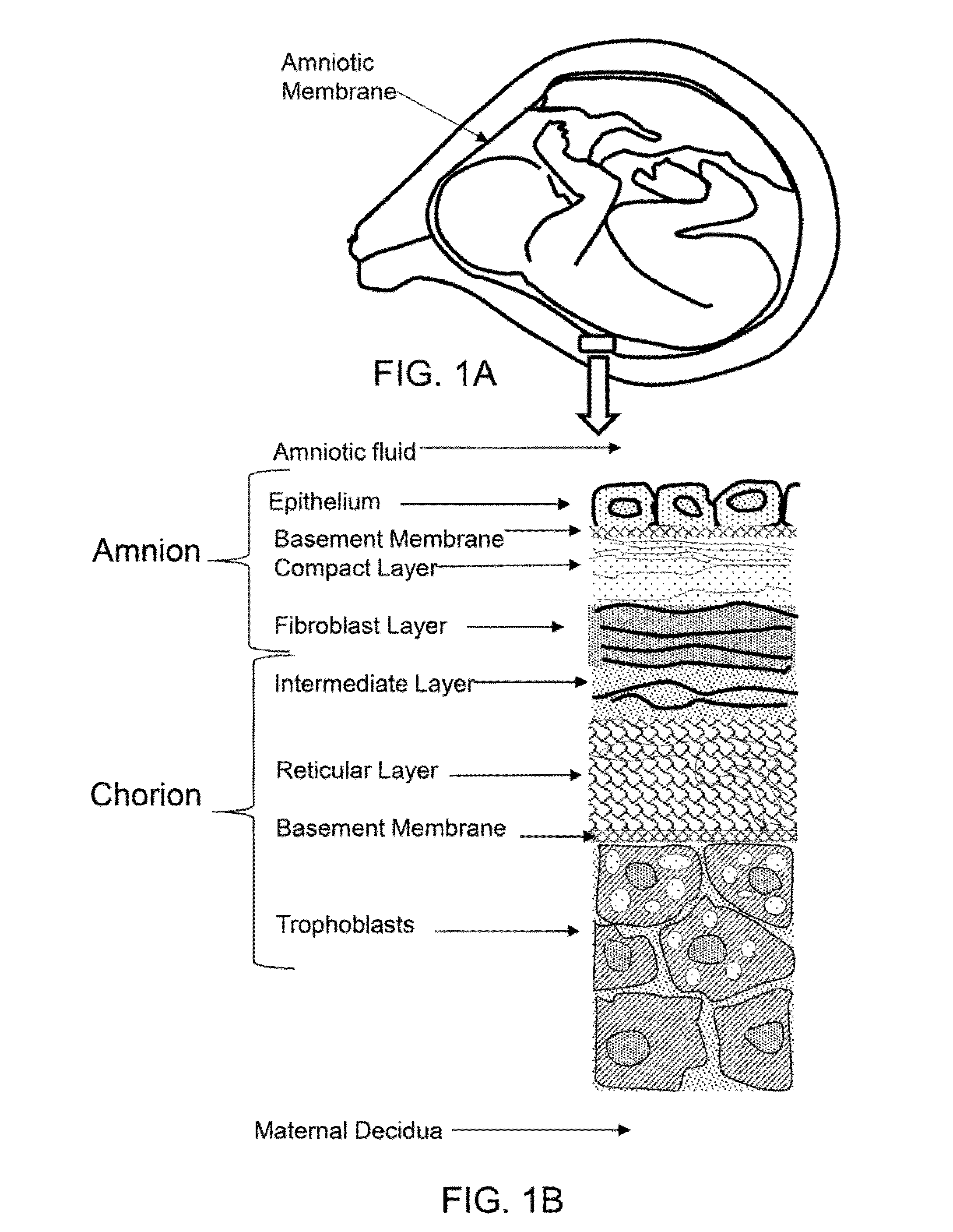 Method of treatment utilizing an acellular amnion derived therapeutic composition