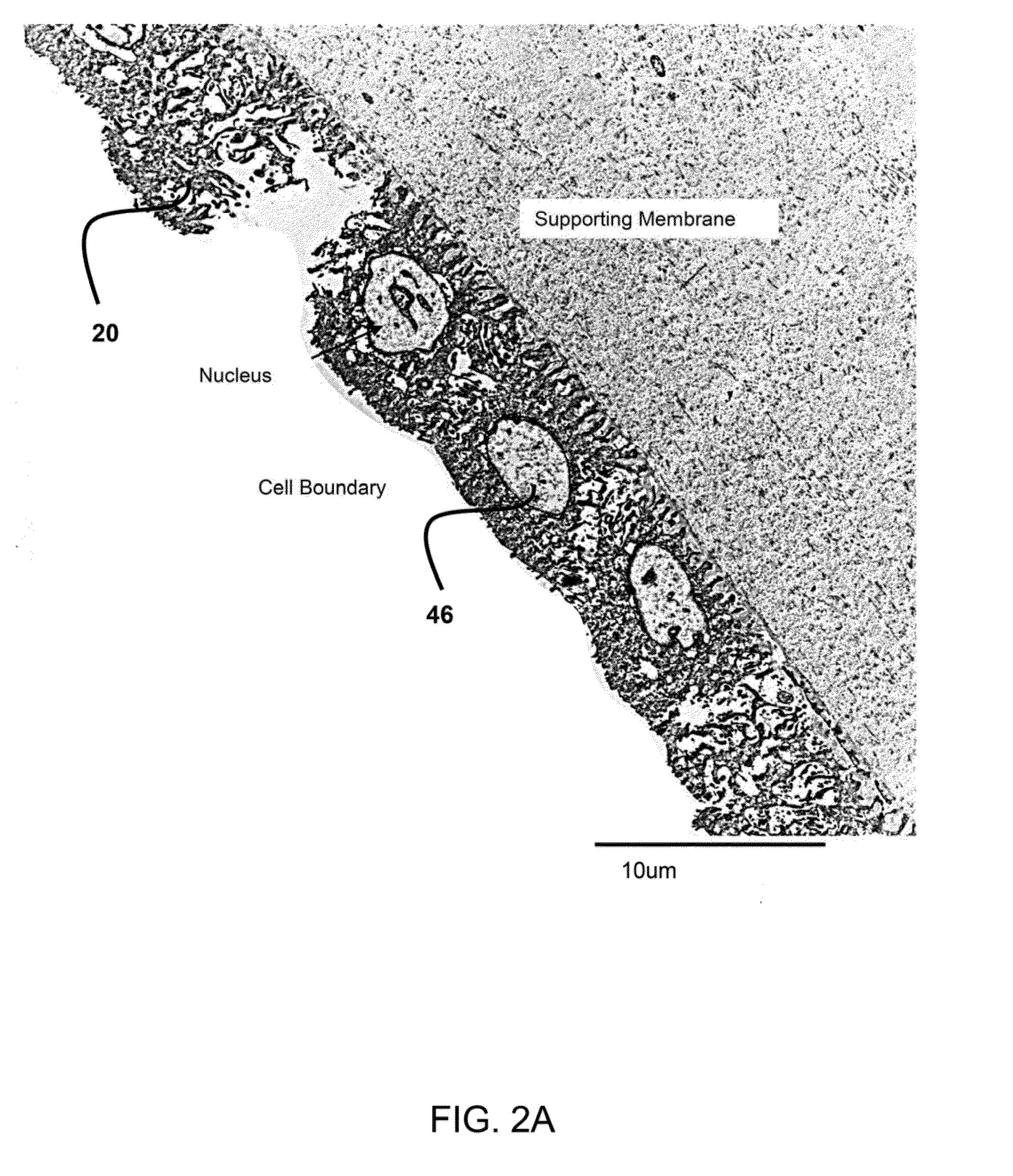 Method of treatment utilizing an acellular amnion derived therapeutic composition