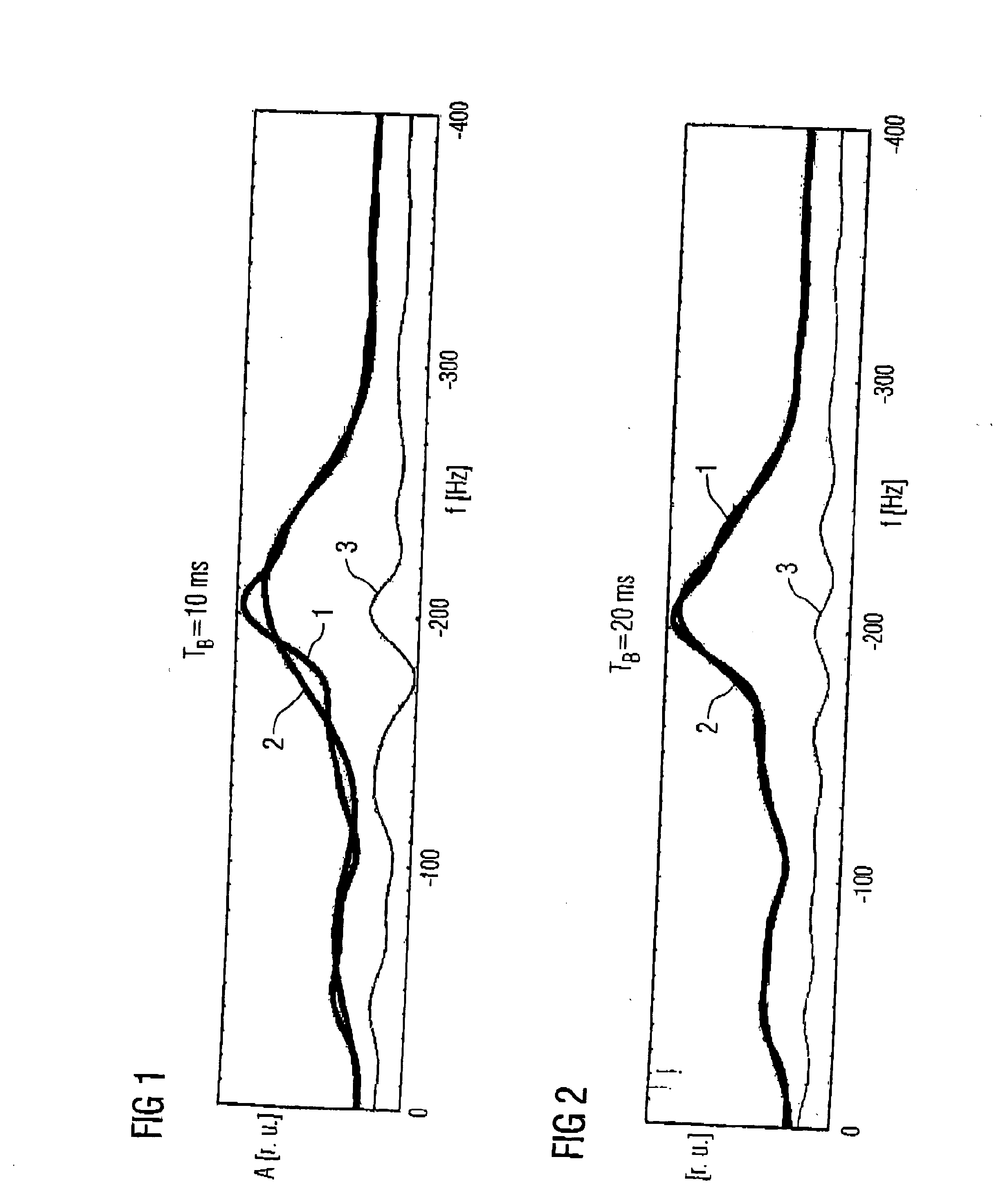 Method for evaluating magnetic resonance spectroscopy data using a baseline model