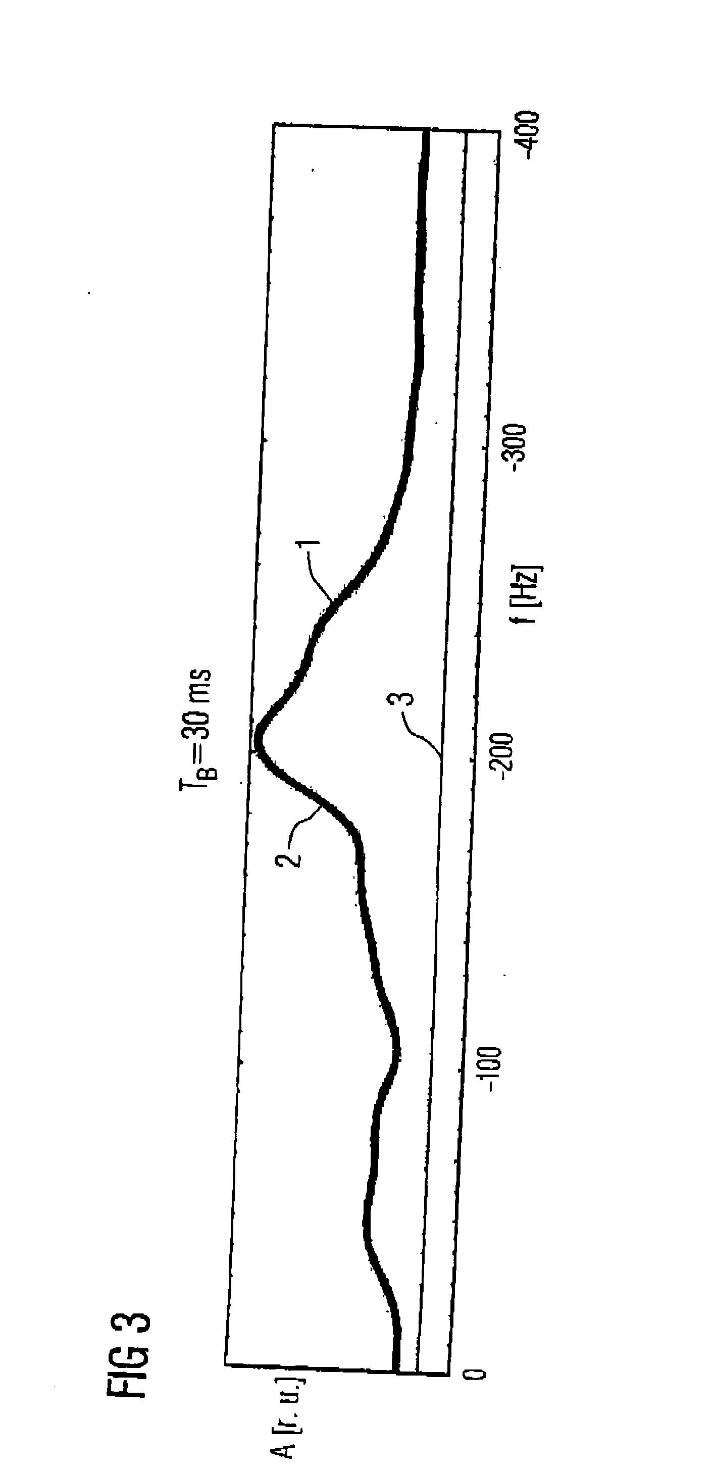 Method for evaluating magnetic resonance spectroscopy data using a baseline model