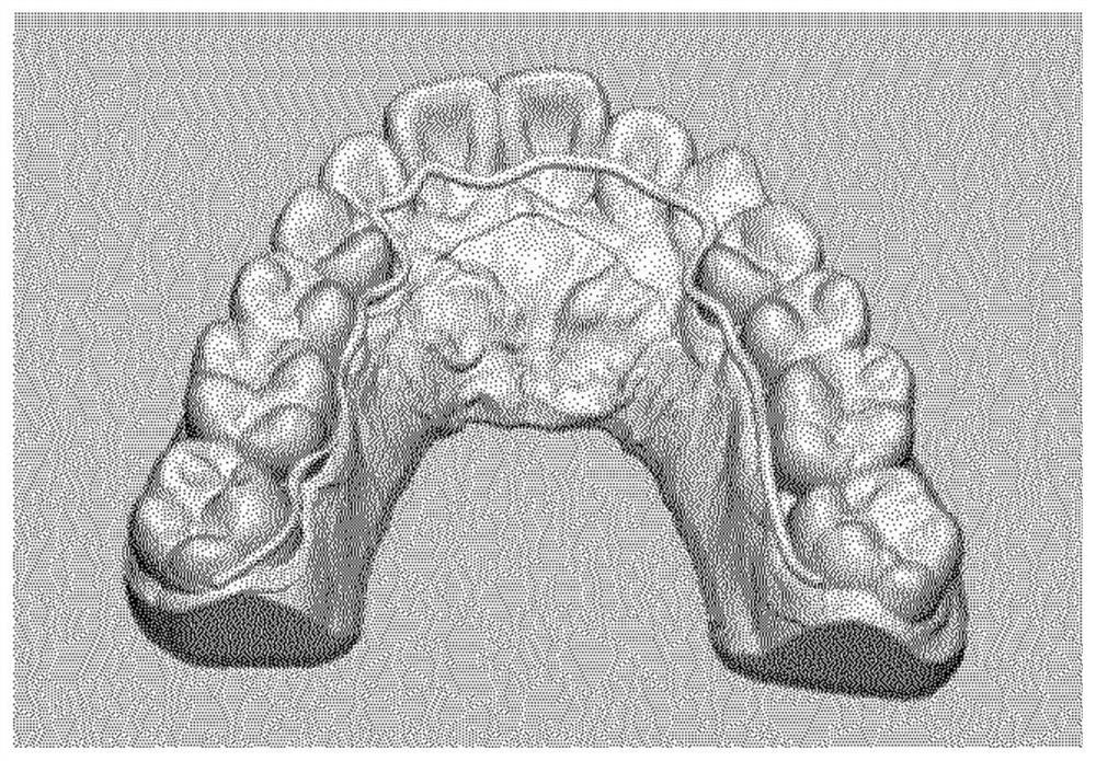 Photocurable composition for 3D printer for producing transparent orthodontic device