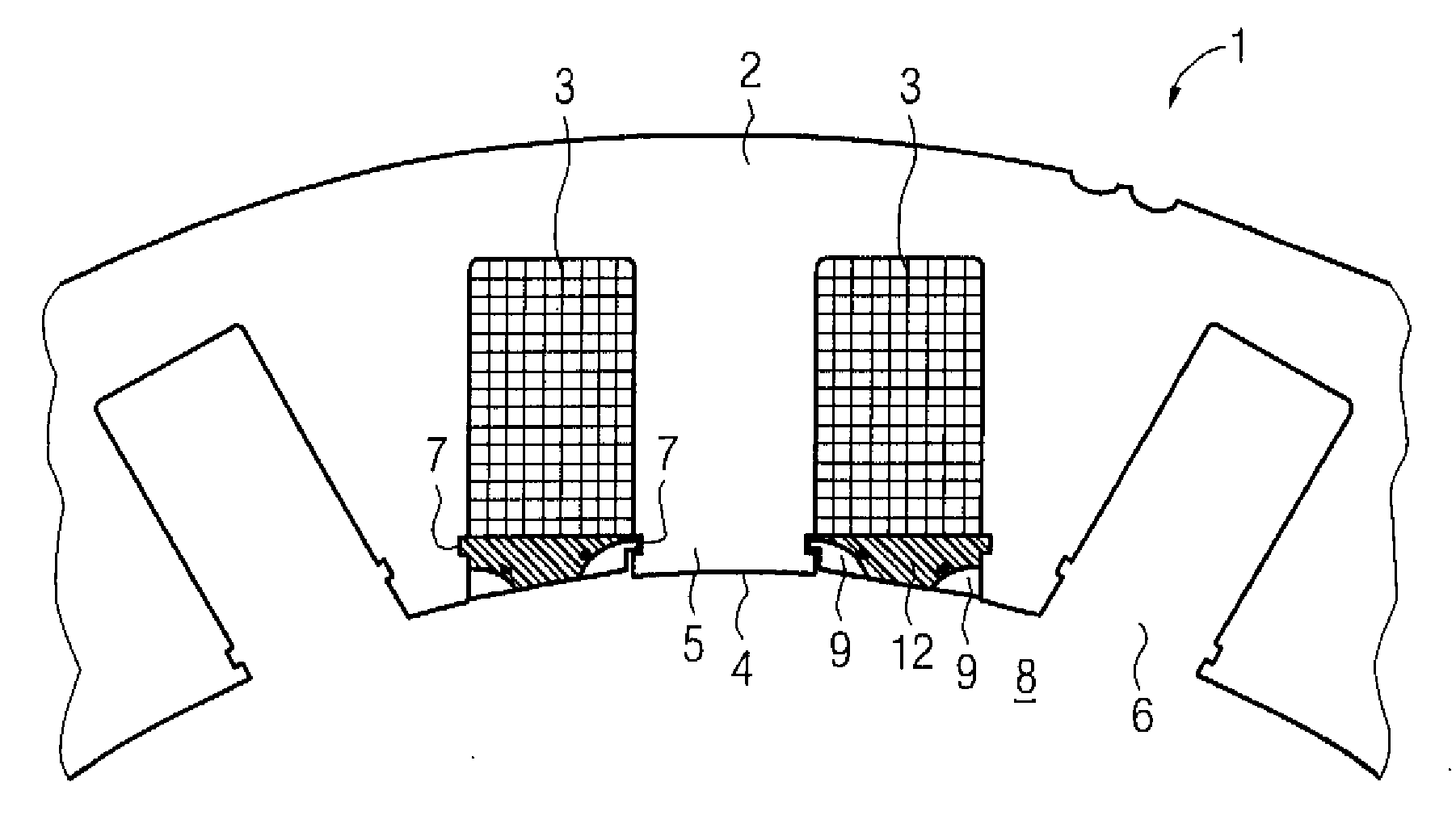 Dynamo-electrical machine with tooth-wound coils