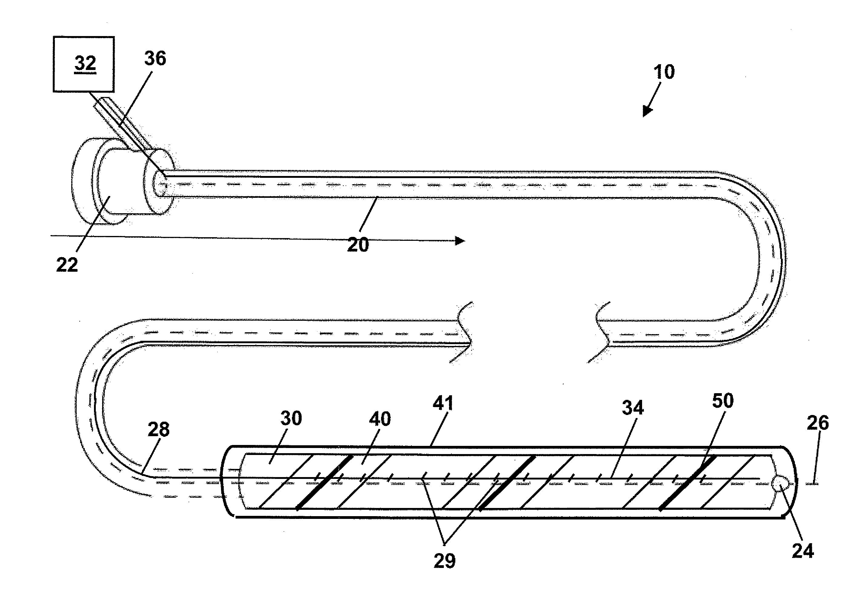 Stent, intraluminal stent delivery system, and method of treating a vascular condition