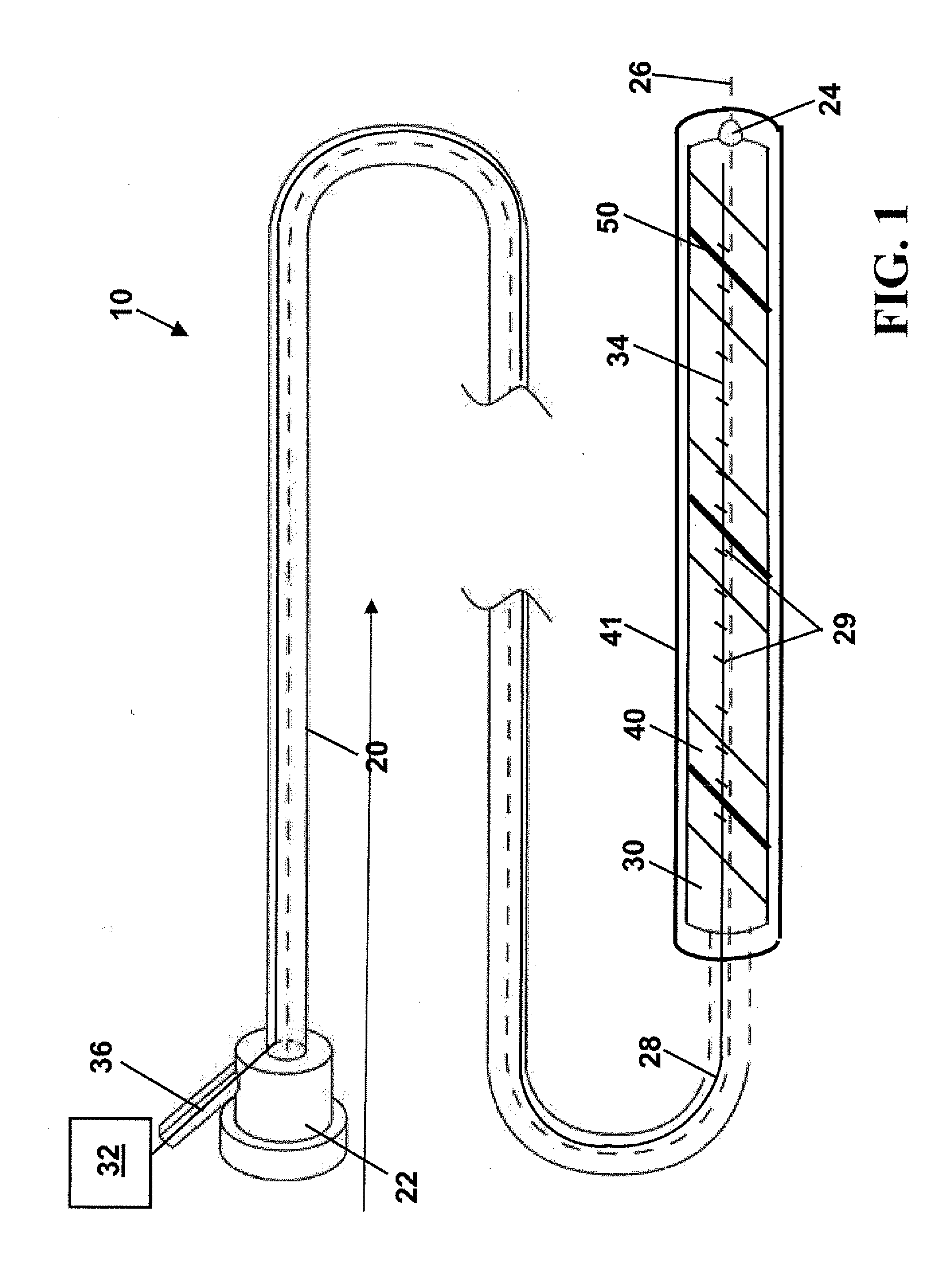 Stent, intraluminal stent delivery system, and method of treating a vascular condition