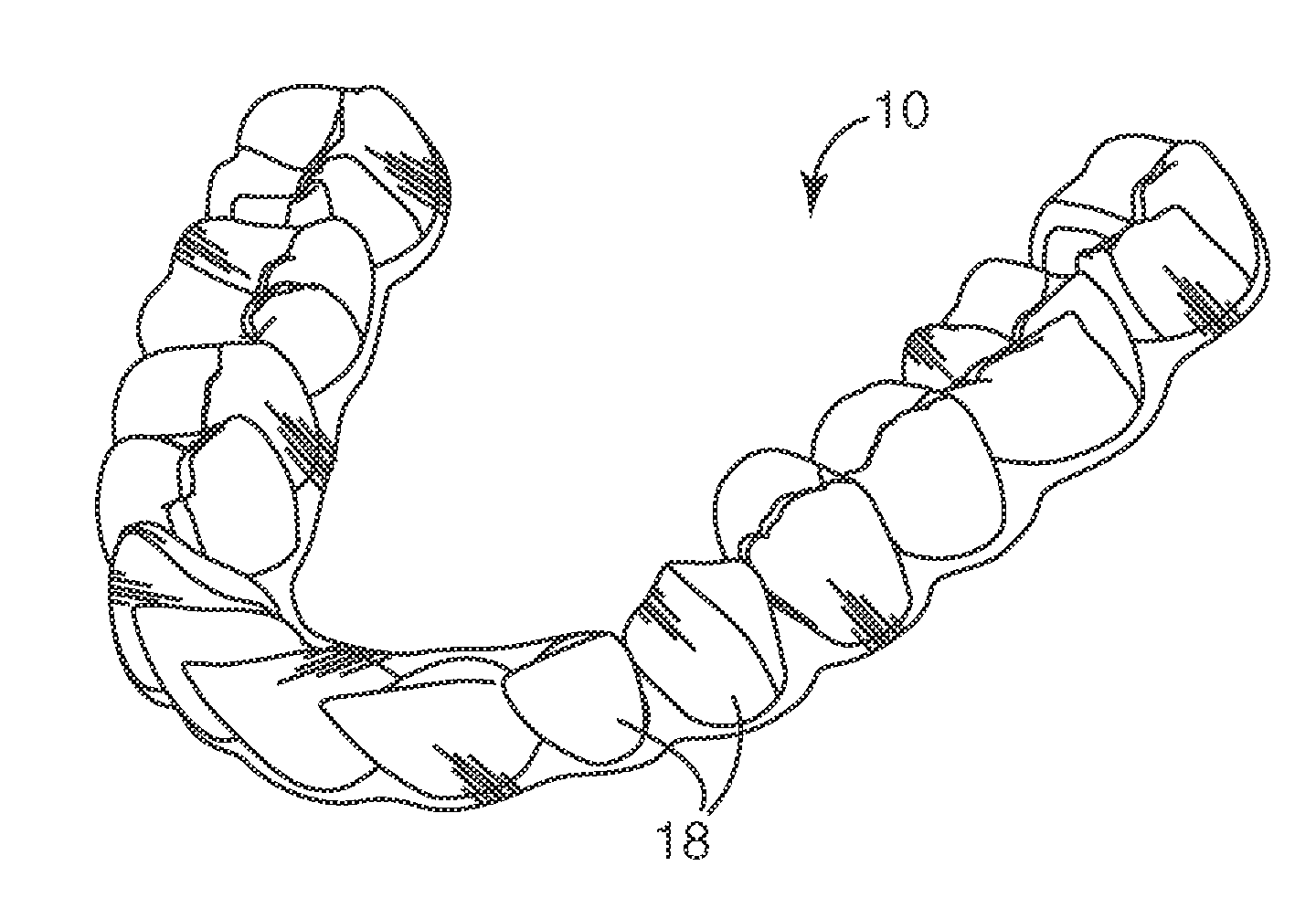 Orthodontic systems with resilient appliances