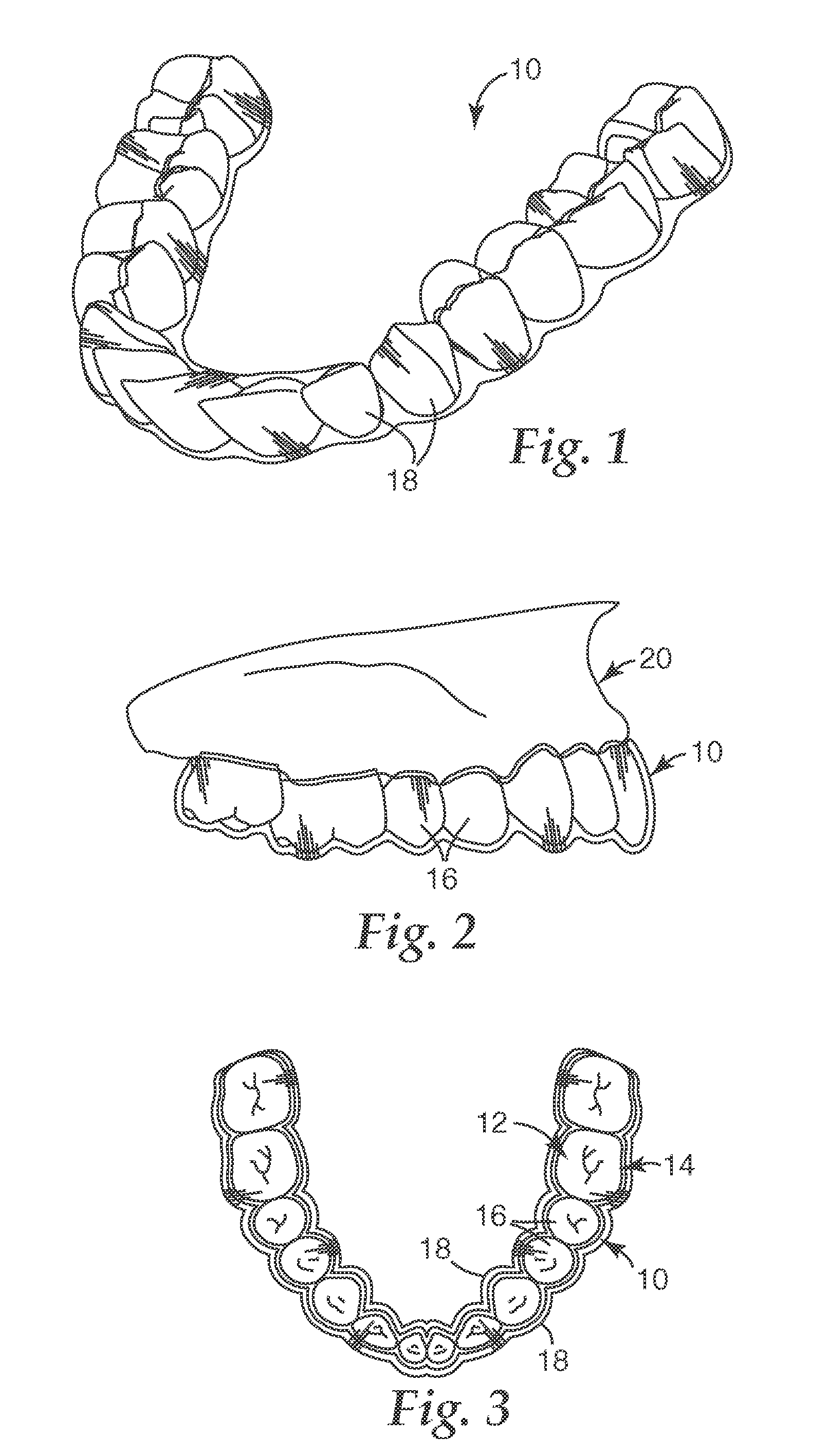 Orthodontic systems with resilient appliances