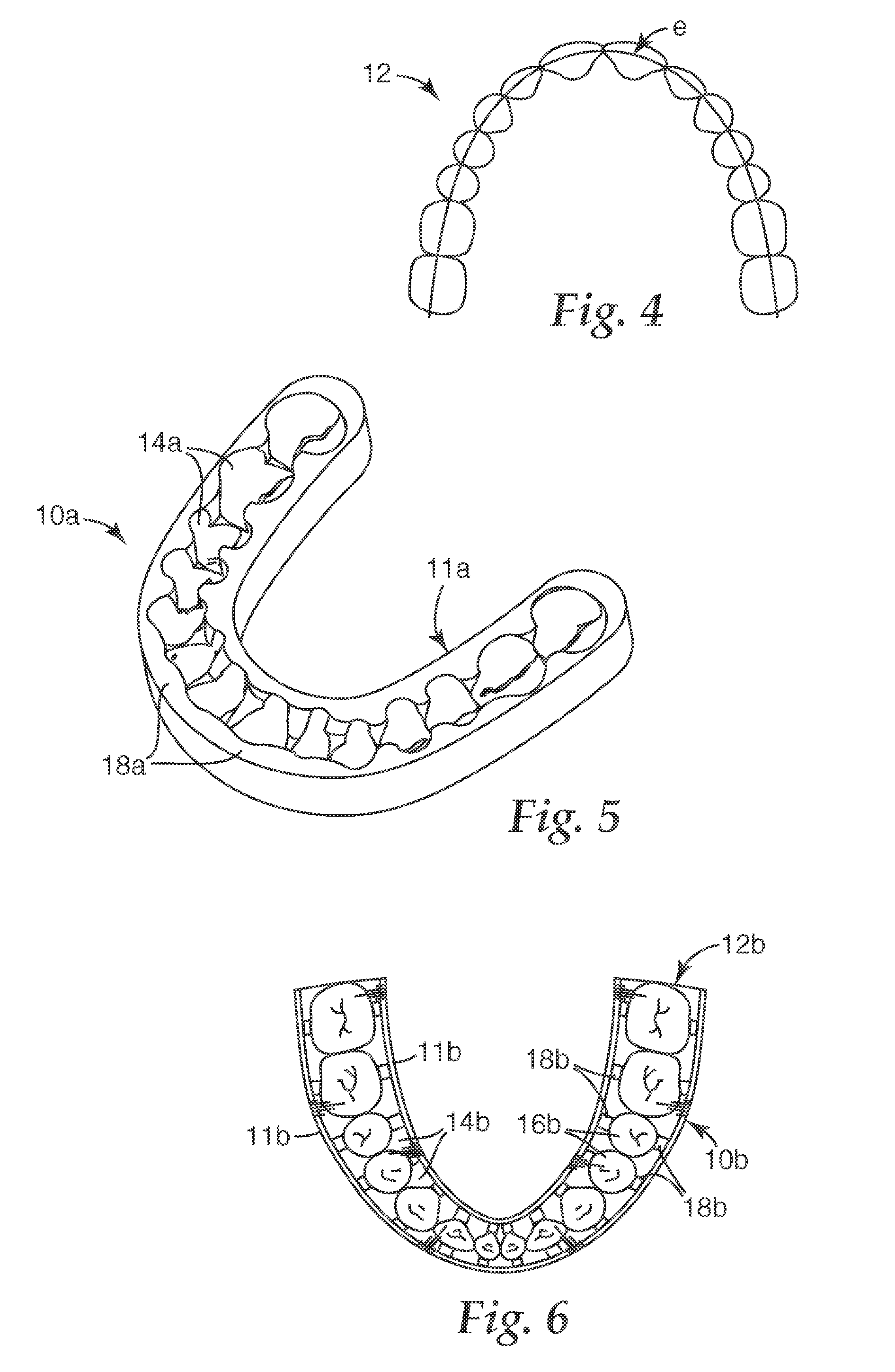 Orthodontic systems with resilient appliances