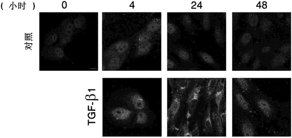 Treatments for proliferative vitreoretinopathy