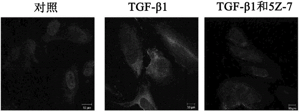 Treatments for proliferative vitreoretinopathy