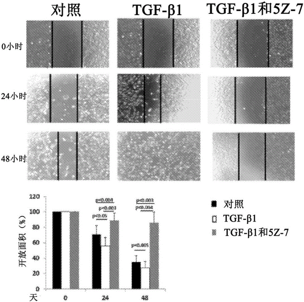 Treatments for proliferative vitreoretinopathy