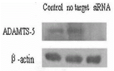 SiRNA (small interfering ribonucleic acid) composition inhibiting ADAMTS-5 (a disintegrin-like and metalloproteinase with thrombospondin type 1motifs-5) and ADAM17 (a disintegrin-like and metalloproteinase with thrombospondin type 1motifs 17) genes and application of siRNA composition