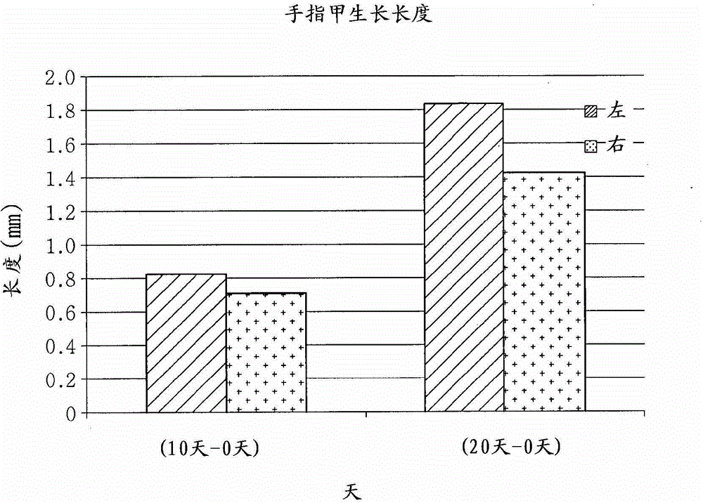 Composition for promoting fingernail or toenail growth