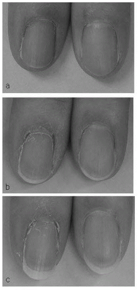 Composition for promoting fingernail or toenail growth