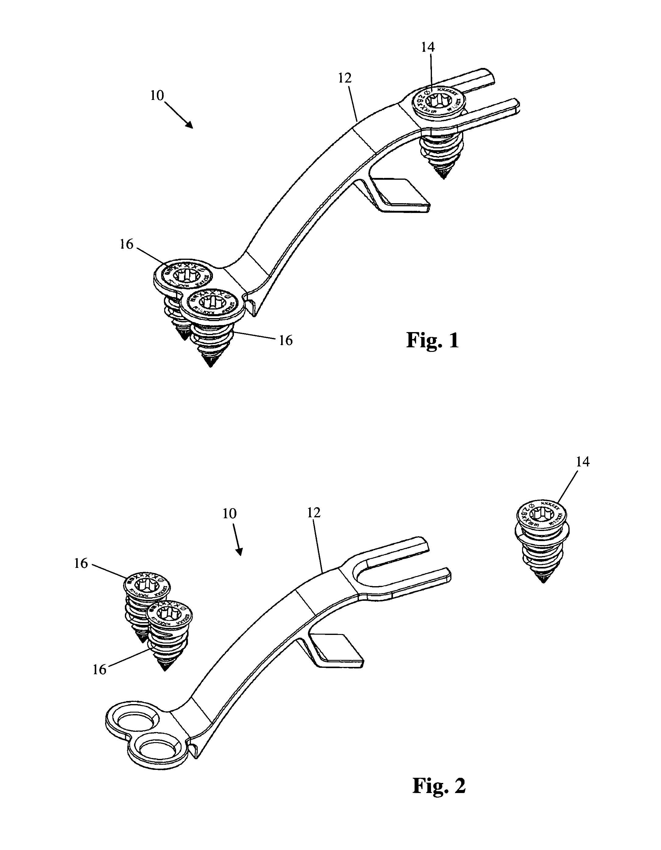 Bone plate system and related methods