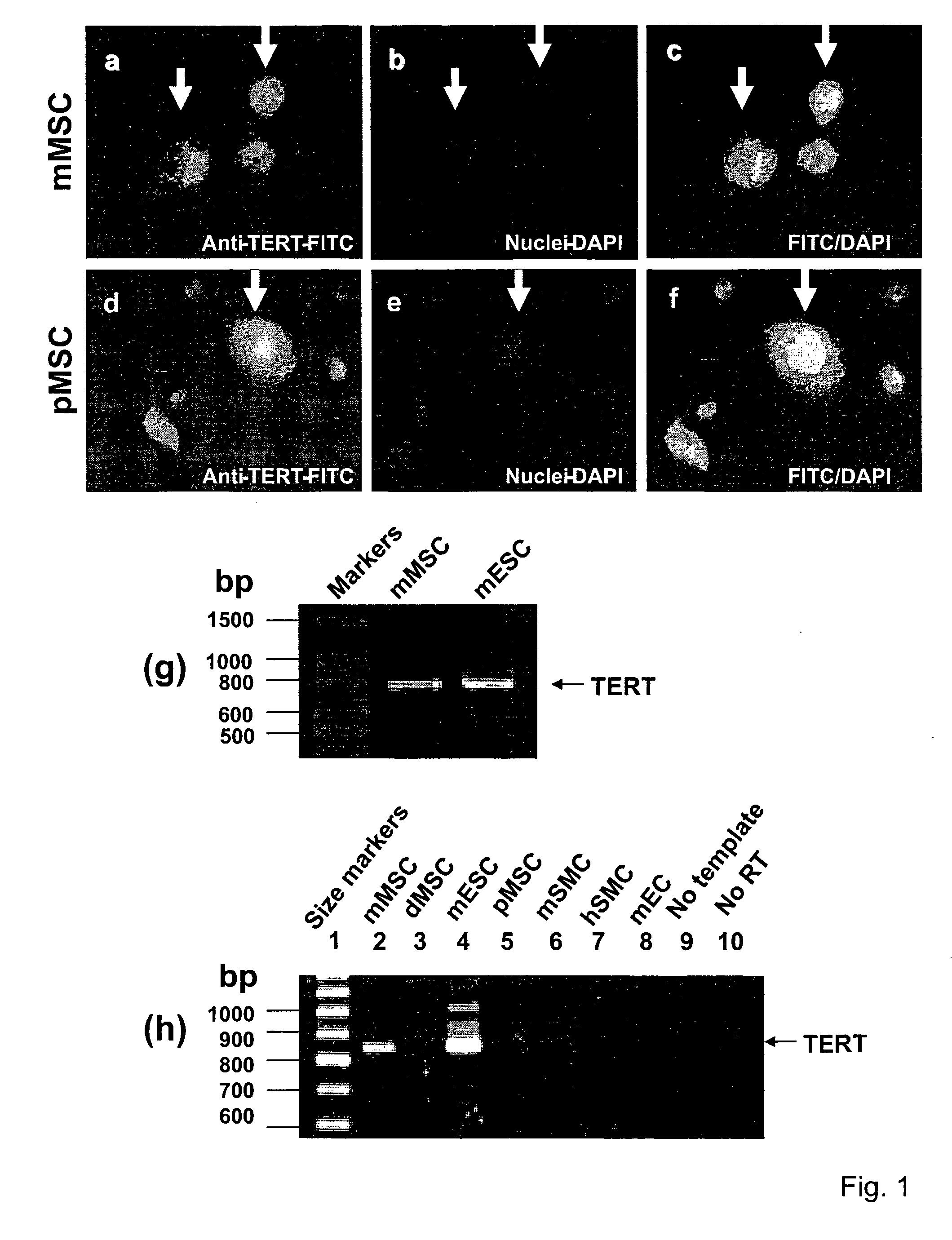 Compositions and Methods for Myogenesis of Fat-Derived Stem Cells Expressing Telomerase and Myocardin