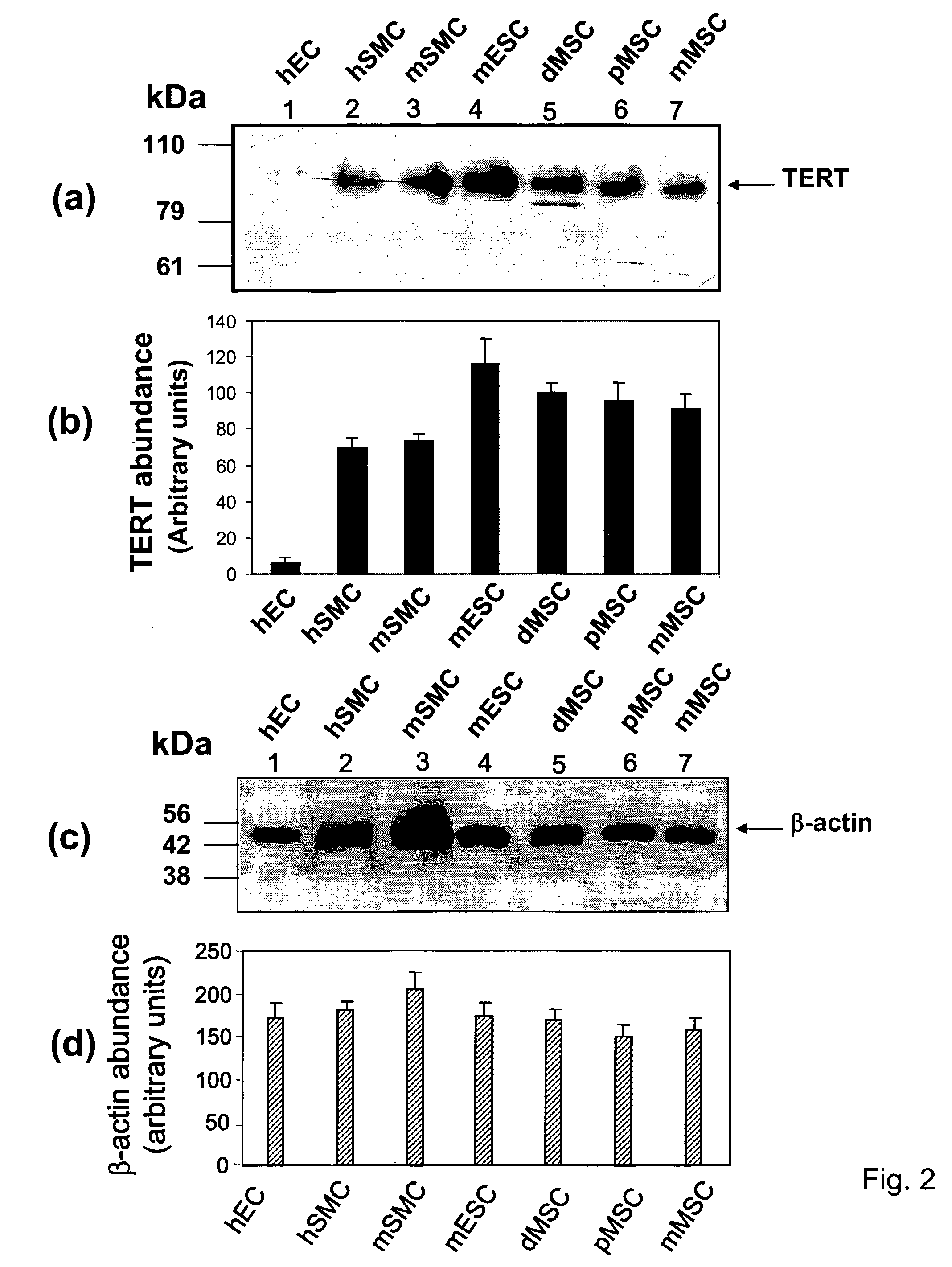 Compositions and Methods for Myogenesis of Fat-Derived Stem Cells Expressing Telomerase and Myocardin