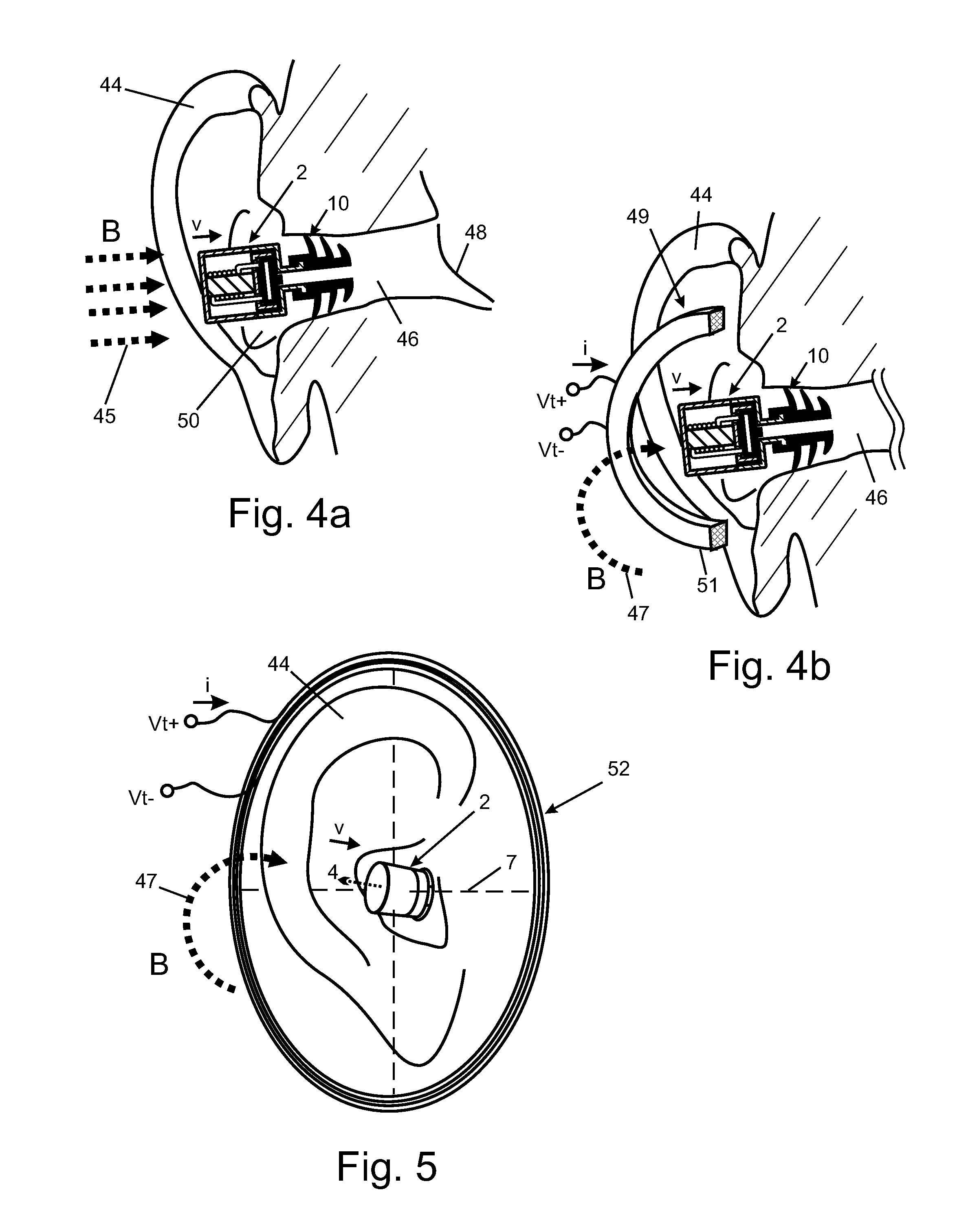 Magnetic Field Antenna