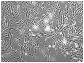 Method for efficiently obtaining adipose-derived mesenchymal stem cells from trace fat