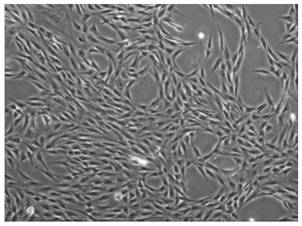 Method for efficiently obtaining adipose-derived mesenchymal stem cells from trace fat