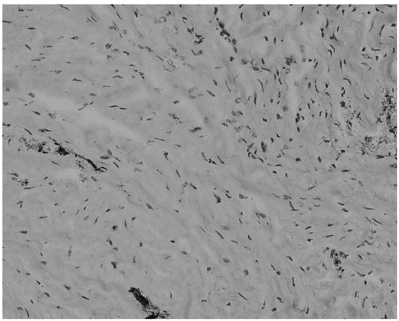 Decellularized corneal limbus protective liquid and preparation method of decellularized corneal limbus